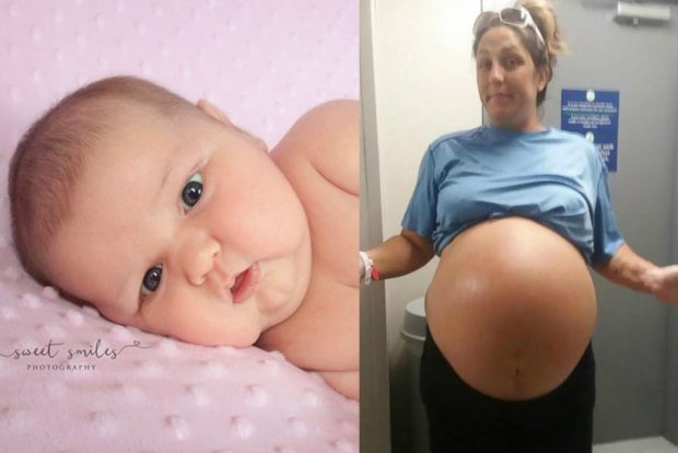 6 Kilo Doğduğu İçin Bir Anda Herkesin İlgi Odağı Olan Dünyalar Tatlısı Bebek