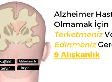 Alzheimer Hastası Olmamak İçin Terketmeniz Ve Edinmeniz Gereken 9 Alışkanlık