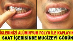 Dişlerinizi alüminyum folyo ile kaplayın.. 1 saat içerisinde mucizeye şait olun