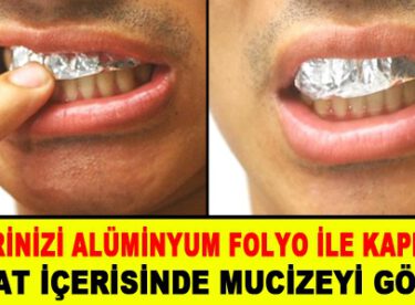 Dişlerinizi alüminyum folyo ile kaplayın.. 1 saat içerisinde mucizeye şait olun