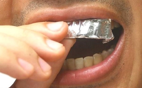 Dişlerinizi alüminyum folyo ile kaplayın.. 1 saat içerisinde mucizeye