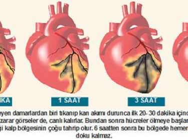 Kalp krizinde hayat kurtaran yöntemler İlk 60 Saniyede İşte Bu Yöntemle Hayatını Kurtarabilirsiniz