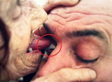 Mucize şifalı dil: Hastaların gözlerini yalayarak körlüğü iyileştiriyor