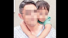 Şişli Etfal Eğitim ve Araştırma Hastanesi’nde 8 aylıkken beyin ameliyatı oldu, sırtı ve kalçası yandı. Baba tepki gösterince doktorun verdiği cevap şoke etti