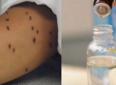 Sivrisineklerden Nefret Mi Ediyorsunuz? – İşte Doktorların Önerdiği Gelmiş Geçmiş En Etkili Sivrisinek Önleyici
