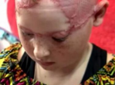 11 Yaşındaki Kız Ve Annesi Lunaparka Gitti – Annesinin Gözleri Önünde Kızın Kafa Derisi Yüzüldü