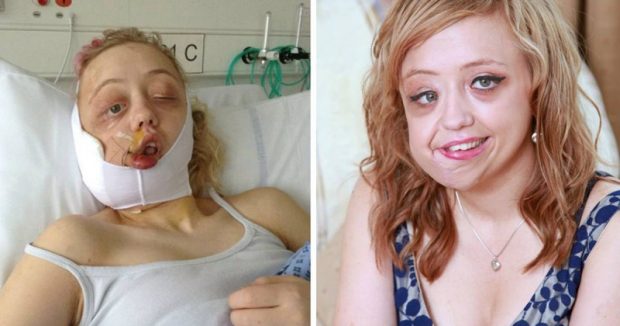 22 Yıl Boyunca Kendisiyle Dalga Geçildi – Hayatını Eski Dostu Böyle Değiştirdi