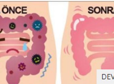Bağırsak temizleyen ev yapımı ilaç