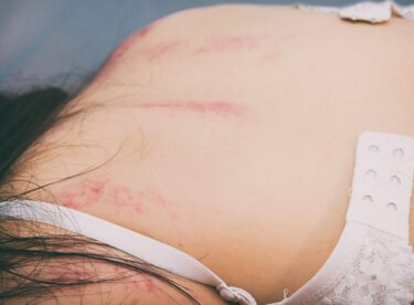 Tecavüz Vakalarının Önüne Geçmek İsteyen Üç Genç Kız Bakın Nasıl Bir Buluş Yaptılar