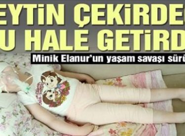 Minik Elanur zeytin çekirdeği yüzünden yatağa mahkum oldu