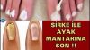 SİRKE İLE AYAK MANTARINA SON !! DENEYENLER 1 GECE DE KURTULUYOR…