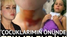 ‘Kızımı yaktılar’