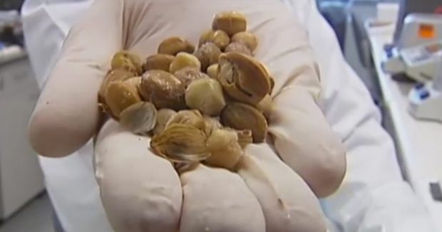 Avustralyada Yeni Bulunan Meyve İle Kanser Önlenebilecek
