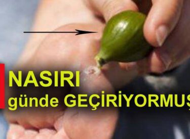 Nasırı 1 günde geçirecek tedavi yöntemleri