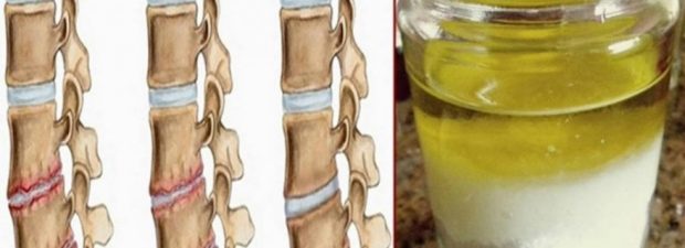 Vücuttaki Ağrıları Tuz Zeytinyağı Karışımı ile Geçirin