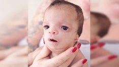 Bebeğin Suratını Görünce Evlat Edinmek İsteyen Aile Bebekten Vazgeçti – Biyolojik Annesi Bakın Ne Yaptı