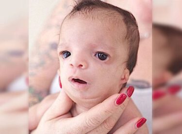 Bebeğin Suratını Görünce Evlat Edinmek İsteyen Aile Bebekten Vazgeçti – Biyolojik Annesi Bakın Ne Yaptı