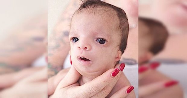 Bebeğin Suratını Görünce Evlat Edinmek İsteyen Aile Bebekten Vazgeçti – Biyolojik Annesi Bakın Ne Yaptı