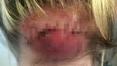 Dört Doktor Da Bir Şeyi Olmadığını Söyledi – Beşince Doktor Acı Haberi Böyle Verdi