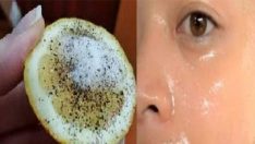 Siyah Noktalardan ve Ölü Deriden Kurtulmak Artık Çok Kolay Mucizevi Limon Yöntemini Denediniz mi ?