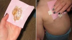 Öksürüğe Doğal Çözüm – Anında Rahatlayacaksınız
