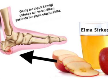 Evinizden Elma Sirkesi Eksik Olmasın