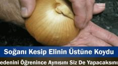 Soğanı Kesip Elinin Üstüne Koydu Nedenini Öğrenince Aynısını Siz De Yapacaksınız.