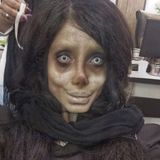 Her Şeyi Angelina Jolie’ye benzemek için yaptı servet harcadı 40 kiloya düştü 50’den fazla estetik ameliyat oldu