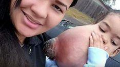 Çenesinden 2 Kiloluk Tümör Çıkarılan 3 Yaşındaki Kız Bakın Bugün Nasıl Görünüyor Yüzündeki O Mutluluk Her Şeye Değer