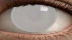 Gece karanlıkta bu şekilde telefon kullanmak geçici körlüğe neden oluyor