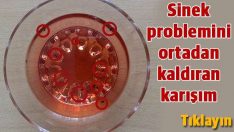 Bir gecede içinde ölü sinek kaynadığını göreceksiniz…