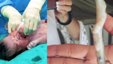 Bebek ağlayarak doğdu, doktorlar gerçeği görünce şoke oldu