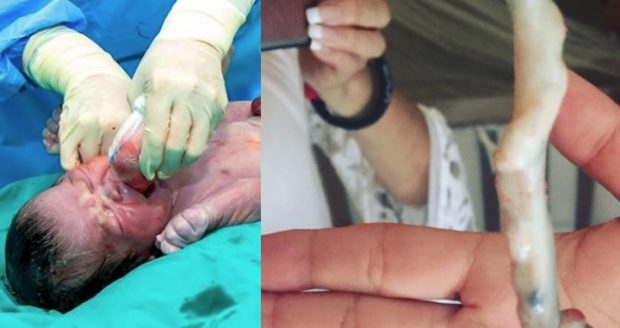 Bebek ağlayarak doğdu, doktorlar gerçeği görünce şoke oldu