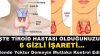 İşte Tiroid Hastası Olduğunuzun 6 Gizli İşareti – Bende Yoktur Demeyin Mutlaka Kontrol Edin.