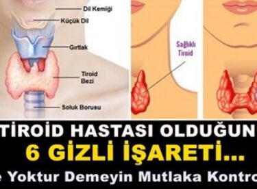 İşte Tiroid Hastası Olduğunuzun 6 Gizli İşareti – Bende Yoktur Demeyin Mutlaka Kontrol Edin.