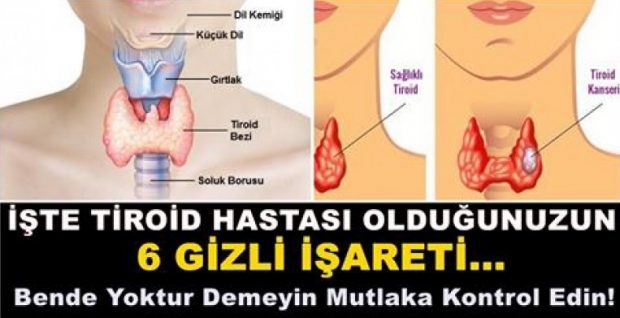 İşte Tiroid Hastası Olduğunuzun 6 Gizli İşareti – Bende Yoktur Demeyin Mutlaka Kontrol Edin.