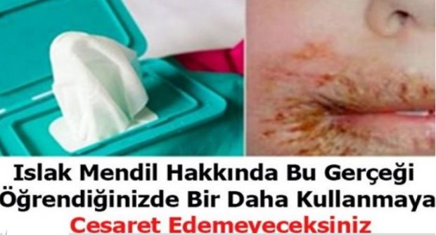 Bu haberi okuduktan sonra, ıslak mendil kullanmayacaksınız