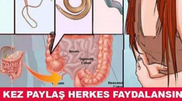 12 saatte bağırsaktaki kurtları dışarı atar…