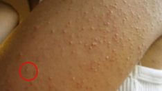 Gluten Duyarlılığınız Olduğunun 6 Net Belirtisi