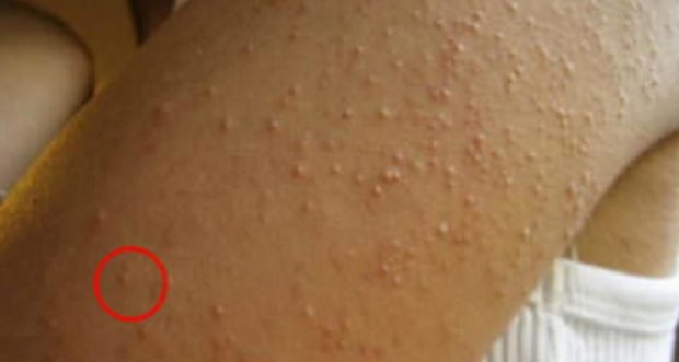 Gluten Duyarlılığınız Olduğunun 6 Net Belirtisi