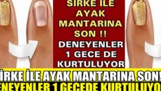 SİRKE İLE AYAK MANTARINA SON !! DENEYENLER 1 GECE DE KURTULUYOR