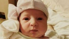Bu gördüğünüz bebek aslında 25 yaşında işte inanılmaz hikayesi