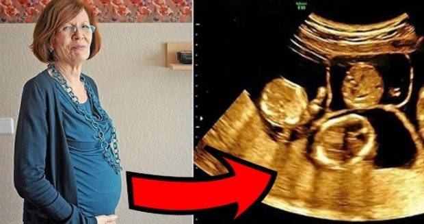 65 Yaşında 13 Çocuğu Ve 7 Torunu Vardı – Ultrasona Girince Doktorlar Gözlerine İnanamadı