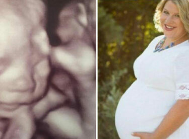 Eşinin Vefatının Ardından Hamile Olduğunu Öğrendi – Ultrasonda Gördüklerine İnanamadı