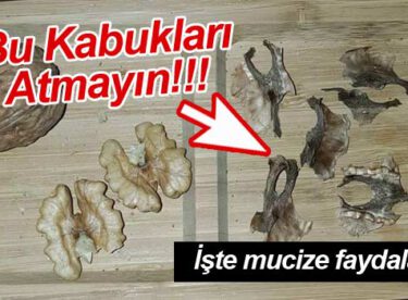 1 Bardak Suya 1 Adet Ceviz İçini Koyun Ve Sabaha kadar Bekletin Sabah Bu Suyu İçtiğinizde