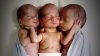 Üçüzleri Dünyaya Getirmek İçin Hastaneye Yetiştirildi – Doktor Üçüzlere Bakınca İnanamadı