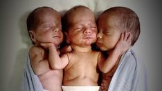 Üçüzleri Dünyaya Getirmek İçin Hastaneye Yetiştirildi – Doktor Üçüzlere Bakınca İnanamadı
