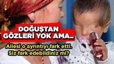 Bebeğin doğuştan gözleri yok ama…