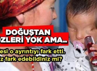 Bebeğin doğuştan gözleri yok ama…