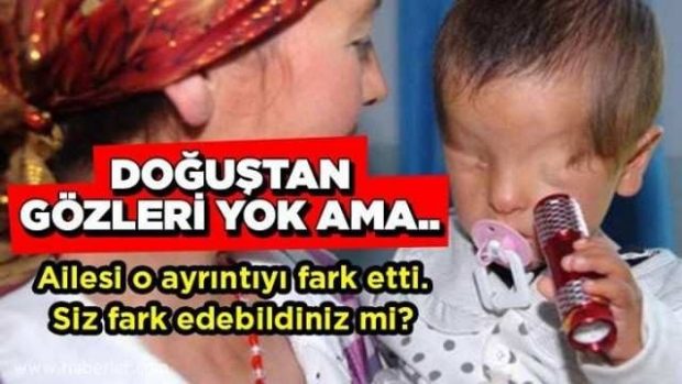 Bebeğin doğuştan gözleri yok ama…